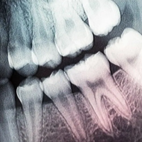 Digital dental X-ray at M Dental Care, Kampala